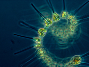 Photo of phytoplankton from the National Oceanic and Atmospheric Administration